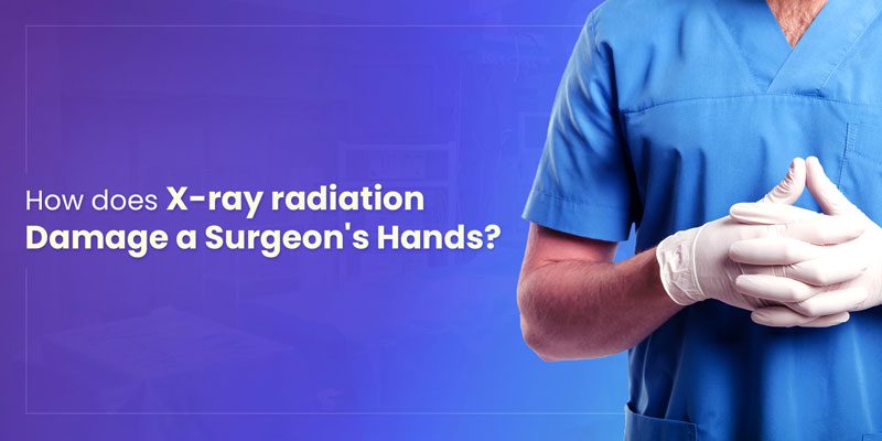 how-does-x-ray-radiation-bnr X-ray radiation damage surgeon's hands